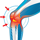 Joint Pain & Arthritis